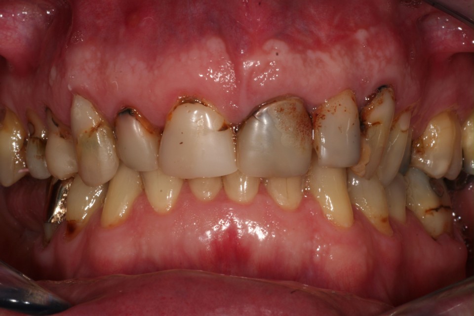 Casus 2 voor behandeling